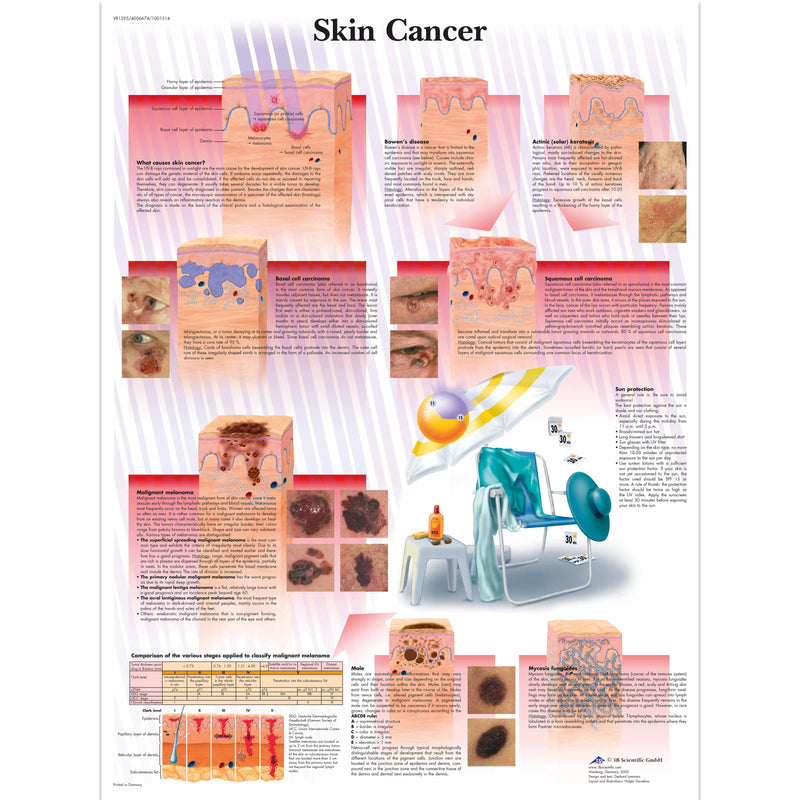 VR1295L_01_3200_3200_Skin-Cancer-Chart
